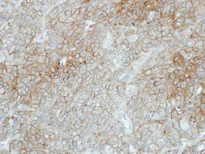 Immunohistochemistry-Paraffin: Flotillin 2 Antibody [NBP2-16507] - Immunohistochemical analysis of paraffin-embedded BT474 xenograft, using antibody at 1:100 dilution.