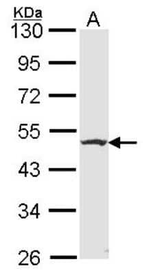 Western Blot: Flotillin 2 Antibody [NBP2-16507] - Sample (30 ug of whole cell lysate) A: HCT116 10% SDS PAGE gel, diluted at 1:1000.