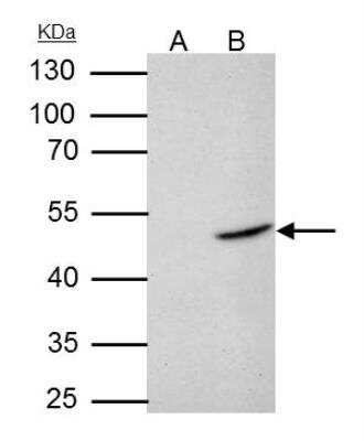 Western Blot: Flotillin 2 Antibody [NBP2-16507] - Flotillin 2 antibody immunoprecipitates Flotillin 2 protein in IP experiments.IP samples: HCT-116 whole cell extract. A. Control with 4 ug of preimmune Rabbit IgG. B. Immunoprecipitation of Flotillin 2 protein by 4 ug Flotillin 2 antibody. 10 % SDS-PAGE. The immunoprecipitated Flotillin 2 protein was detected by Flotillin 2 antibody diluted at 1:1000.