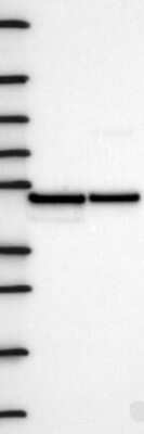 Western Blot: Flotillin 2 Antibody [NBP3-17714] - Lane 1: Marker [kDa] 250, 130, 95, 72, 55, 36, 28, 17, 10;   Lane 2: RT4;   Lane 3: U-251 MG