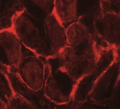 Immunocytochemistry/Immunofluorescence: Flt-3/Flk-2/CD135 Antibody [NBP2-41188] - Immunofluorescence of FLT3 in human kidney tissue with FLT3 antibody at 20 ug/mL.