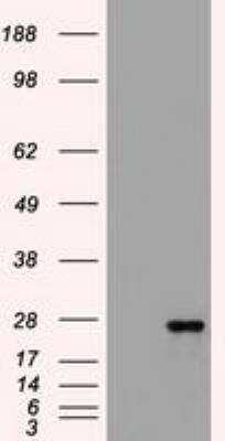 Western Blot: Flt-3 Ligand Antibody (8D10) [NBP1-47756] - HEK293T cells were transfected with the pCMV6-ENTRY control (Left lane) or pCMV6-ENTRY Flt3 ligand (Right lane) cDNA for 48 hrs and lysed. Equivalent amounts of cell lysates (5 ug per lane) were separated by SDS-PAGE and immunoblotted with anti-Flt3 ligand.