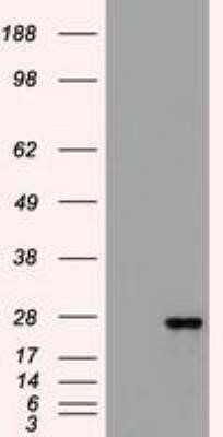 Western Blot: Flt-3 Ligand/FLT3L Antibody (OTI8D10) - Azide and BSA Free [NBP2-70754] - HEK293T cells were transfected with the pCMV6-ENTRY control (Left lane) or pCMV6-ENTRY Flt3 ligand (Right lane) cDNA for 48 hrs and lysed. Equivalent amounts of cell lysates (5 ug per lane) were separated by SDS-PAGE and immunoblotted with anti-Flt3 ligan