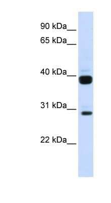 Western Blot: Flt3 ligand Antibody [NBP1-62304] - Human Muscle lysate, concentration 0.2-1 ug/ml.