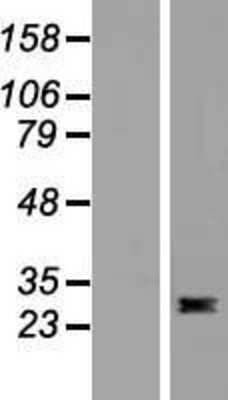 Western Blot Flt-3 Ligand/FLT3L Overexpression Lysate