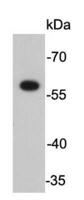 Western Blot: Fok1 Antibody [NBP2-66849] - Analysis on purified restriction enzyme FokI.