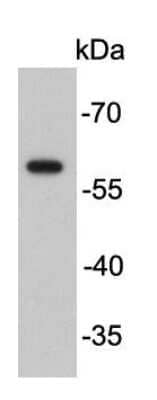 Western Blot: Fok1 Antibody [NBP2-66850] - Analysis on purified restriction enzyme FokI.