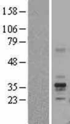 Western Blot: Folate Binding Protein Overexpression Lysate (Adult Normal) [NBP2-10703] Left-Empty vector transfected control cell lysate (HEK293 cell lysate); Right -Over-expression Lysate for Folate Binding Protein.