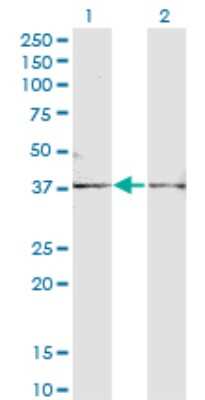 Western Blot: Follistatin Antibody (1G4) [H00010468-M01A] - Analysis of FST expression in transfected 293T cell line by FST monoclonal antibody (M01A), clone 1G4.Lane 1: FST transfected lysate (Predicted MW: 38 KDa).Lane 2: Non-transfected lysate.