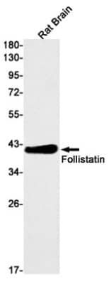 Western Blot: Follistatin Antibody (S08-8F4) [NBP3-19636] - Western blot detection of Follistatin in Rat Brain lysates using NBP3-19636 (1:1000 diluted). Predicted band size: 38kDa. Observed band size: 38kDa.