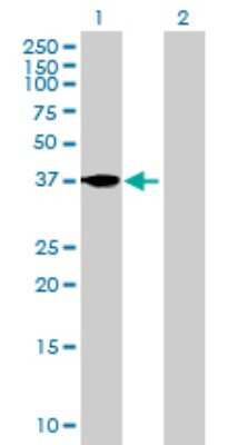 Western Blot: Follistatin Antibody [H00010468-B01P] - Analysis of FST expression in transfected 293T cell line by FST polyclonal antibody.  Lane 1: FST transfected lysate(37.84 KDa). Lane 2: Non-transfected lysate.