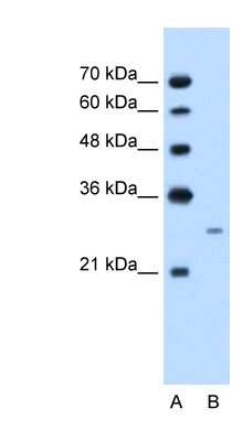 Western Blot: Follistatin Antibody [NBP1-57996] - Jurkat cell lysate, concentration 2.5 ug/ml.