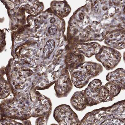 Immunohistochemistry: Follistatin-like 1/FSTL1 Antibody [NBP2-68590] - Immunohistochemical staining of human placenta shows strong cytoplasmic positivity in trophoblastic cells.
