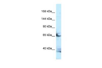 Western Blot: Follistatin-like 4/FSTL4 Antibody [NBP3-09413] - Western blot analysis of Follistatin-like 4/FSTL4 in HepG2 Whole Cell lysates. Antibody dilution at 1.0ug/ml