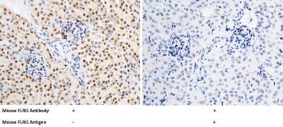 Immunohistochemistry-Paraffin: Follistatin-related Gene Protein/FLRG/Fstl3 Antibody [NBP2-98212] - Immunochemical staining of mouse Follistatin-related Gene Protein/FLRG/Fstl3 in mouse lung with rabbit polyclonal antibody (1:1000, formalin-fixed paraffin embedded sections).