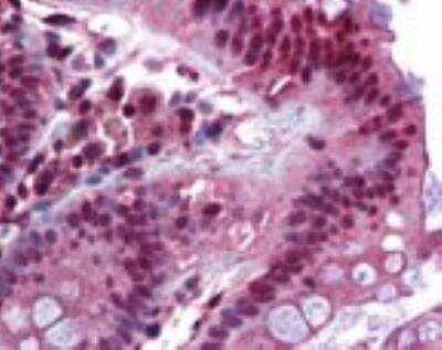 Immunohistochemistry-Paraffin: FoxC1 Antibody [NBP2-24834] -  Analysis of human colon using this antibody.