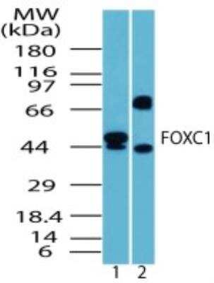 Western Blot: FoxC1 Antibody [NBP2-24834] -  Analysis of human FOXC1 in human liver lysate in the 1) absence, 2) presence of immunizing peptide using this antibody at 1:1000 dilution.