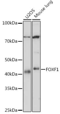 Western Blot: FoxF1 Antibody (8F6G3) [NBP3-16637] - Analysis of extracts of various cell lines, using FoxF1 antibody (NBP3-16637) at 1:1000 dilution. Secondary antibody: HRP Goat Anti-Rabbit IgG (H+L) at 1:10000 dilution. Lysates/proteins: 25ug per lane. Blocking buffer: 3% nonfat dry milk in TBST. Detection: ECL Basic Kit. Exposure time: 10s.