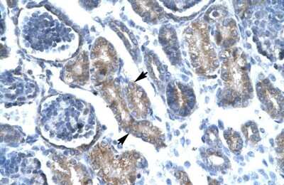 Immunohistochemistry: FoxF1 Antibody [NBP2-87467] - Human kidney