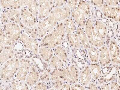 Immunohistochemistry-Paraffin: FoxF1 Antibody [NBP2-98870] - Immunochemical staining of human FoxF1 in human kidney with rabbit polyclonal antibody (1:300, formalin-fixed paraffin embedded sections).