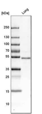 Western Blot: FoxF1 Antibody [NBP1-84670] - Analysis in human lung tissue.