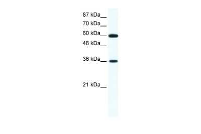 Western Blot: FoxF1 Antibody [NBP2-87466] - WB Suggested Anti-FOXF1 Antibody Titration: 1.25ug/ml. ELISA Titer: 1:1562500. Positive Control: Jurkat cell lysate