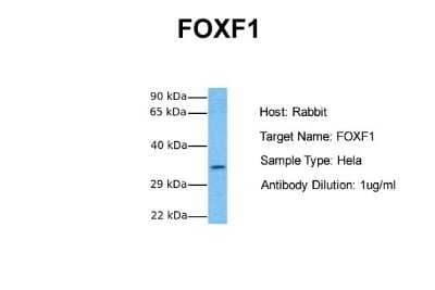 Western Blot: FoxF1 Antibody [NBP2-87467] - Host: Rabbit. Target Name: FOXF1. Sample Tissue: Human Hela. Antibody Dilution: 1.0ug/ml