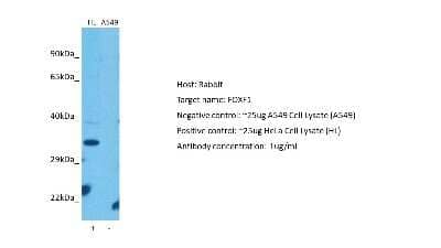 Western Blot: FoxF1 Antibody [NBP2-87467] - Host: Rabbit. Target: FOXF1. Positive control (+): Hela (HL). Negative control (-): A549 (N03). Antibody concentration: 1ug/ml