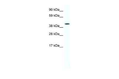 Western Blot: FoxF1 Antibody [NBP2-87468] - WB Suggested Anti-FOXF1A Antibody Titration: 2.5ug/ml. ELISA Titer: 1:12500. Positive Control: SP2/0 cell lysate