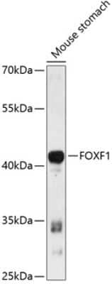 Western Blot: FoxF1 Antibody [NBP3-04753] - Analysis of extracts of mouse stomach, using FoxF1 antibody at 1:3000 dilution. Secondary antibody: HRP Goat Anti-Rabbit IgG (H+L) at 1:10000 dilution. Lysates/proteins: 25ug per lane. Blocking buffer: 3% nonfat dry milk in TBST. Detection: ECL Enhanced Kit.