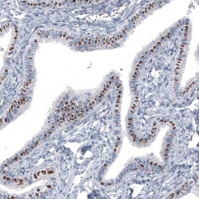 Immunohistochemistry-Paraffin: FoxJ1/HFH4 Antibody (CL3989) [NBP2-59032] - Staining of human fallopian tube shows moderate to strong nuclear positivity in glandular cells.