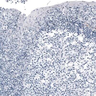 Immunohistochemistry-Paraffin: FoxJ1/HFH4 Antibody (CL3989) [NBP2-59032] - Staining of human tonsil shows no positivity in germinal center cells as expected.