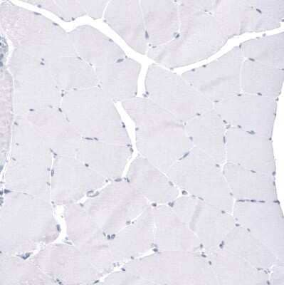 Immunohistochemistry-Paraffin: FoxJ1/HFH4 Antibody (CL3989) [NBP2-59032] - Staining of human skeletal muscle shows no positivity in myocytes as expected.