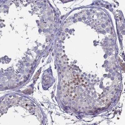 Immunohistochemistry-Paraffin: FoxJ1/HFH4 Antibody [NBP1-87928] - Staining of human testis shows moderate nuclear positivity in a subset of cells in seminiferous ducts.