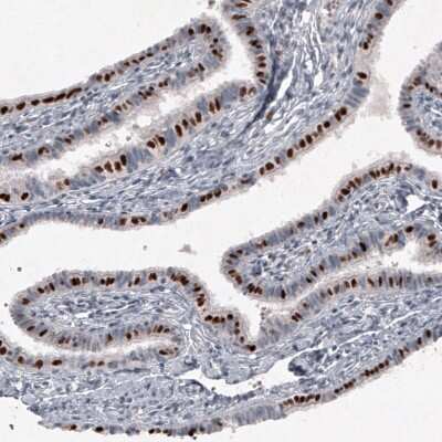 Immunohistochemistry-Paraffin: FoxJ1/HFH4 Antibody [NBP2-59033] - Staining of human fallopian tube shows strong nuclear positivity in glandular cells.