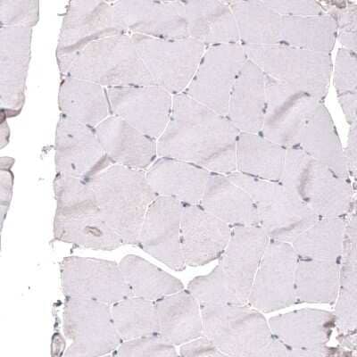 Immunohistochemistry-Paraffin: FoxJ1/HFH4 Antibody [NBP2-59033] - Staining of human skeletal muscle shows no positivity as expected (negative control).