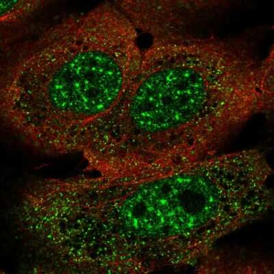 Immunocytochemistry/Immunofluorescence: FoxJ3 Antibody [NBP2-57077] - Staining of human cell line U-2 OS shows localization to nuclear speckles & vesicles.