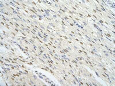 Immunohistochemistry-Paraffin: FoxJ3 Antibody [NBP3-10497] - Immunohistochemical analysis of paraffin-embedded human heart cell tissue.