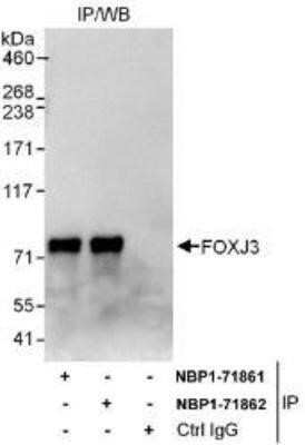 Immunoprecipitation: FoxJ3 Antibody [NBP1-71861] - FOXJ3 Antibody [NBP1-71861] - Whole cell lysate (1 mg for IP, 20% of IP loaded) from K562 cells.  Affinity purified rabbit anti-FOXJ3 antibody used for IP at 6 mcg/mg lysate.  FOXJ3 was also immunoprecipitated by rabbit anti-FOXJ3 antibody NBP1-71862 which recognizes a downstream epitope.