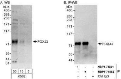 Western Blot: FoxJ3 Antibody [NBP1-71862] - Whole cell lysate (5, 15 and 50 mcg for WB; 1 mg for IP, 20% of IP loaded) from K562 cells.  Affinity purified rabbit anti-FoxJ3 antibody used for WB at 0.1 mcg/ml (A) and 1 mcg/ml (B) and used for IP at 6 mcg/mg lysate.  FoxJ3 was also immunoprecipitated by rabbit anti-FoxJ3 antibody NBP1-71861 which recognizes an upstream epitope.