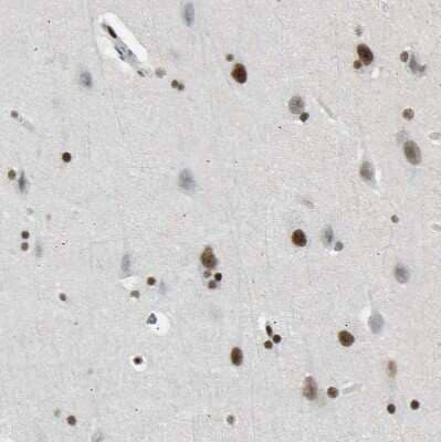 Immunohistochemistry-Paraffin FoxK1 Antibody