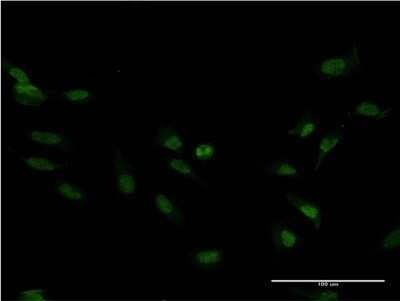 Immunocytochemistry/Immunofluorescence: FoxM1 Antibody (2E2) [H00002305-M07] - Analysis of monoclonal antibody to FOXM1 on HeLa cell. Antibody concentration 10 ug/ml