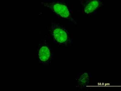 Immunocytochemistry/Immunofluorescence: FoxM1 Antibody (2H4) [H00002305-M05] - Analysis of monoclonal antibody to FOXM1 on HeLa cell. Antibody concentration 20 ug/ml