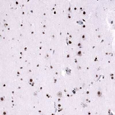 Immunohistochemistry-Paraffin: FoxM1 Antibody (CL12131) [NBP3-15129] - Staining of human cerebral cortex shows moderate to strong nuclear positivity in neurons.