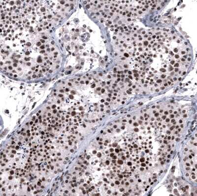 Immunohistochemistry-Paraffin: FoxM1 Antibody (CL12131) [NBP3-15129] - Staining of human testis shows moderate to strong nuclear positivity in cells in seminiferous ducts.