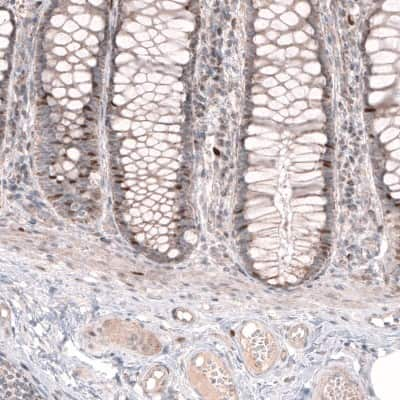 Immunohistochemistry-Paraffin: FoxM1 Antibody [NBP1-84671] - Staining of human rectum shows moderate nuclear positivity in a subset of glandular cells.