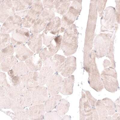 Immunohistochemistry-Paraffin: FoxM1 Antibody [NBP1-84671] - Staining of human skeletal muscle shows no nuclear positivity in striated muscle fibers as expected.