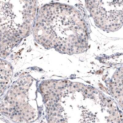 Immunohistochemistry-Paraffin: FoxM1 Antibody [NBP1-84671] - Staining of human testis shows moderate nuclear positivity in few cells in seminiferous ducts.