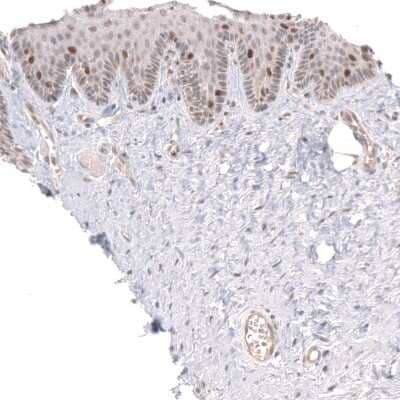 <b>Biological Strategies Validation. </b>Immunohistochemistry-Paraffin: FoxM1 Antibody [NBP1-84671] - Staining of human uterine cervix shows moderate nuclear positivity in a subset of epidermal cells.