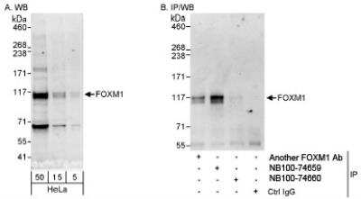 <b>Independent Antibodies Validation and Biological Strategies Validation.</b>Western Blot: FoxM1 Antibody [NB100-74660] - Whole cell lysate (5, 15 and 50 mcg for WB; 1 mg for IP, 20% of IP loaded) from HeLa cells. NB100-74660 used for WB at 0.4 mcg/ml (A) and 1 mcg/ml (B) and used for IP at 3 mcg/mg lysate. FoxM1 was successfully immunoprecipitated by another rabbit anti-FoxM1 antibodies and NB100-74660, which recognize upstream epitopes.